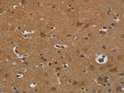 ENTPD7 Antibody (PACO16683)