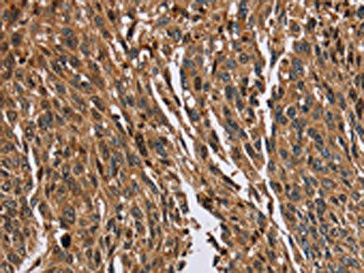 HMGN5 Antibody (PACO16794)