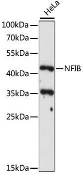 Anti-NFIB Antibody (CAB15294)