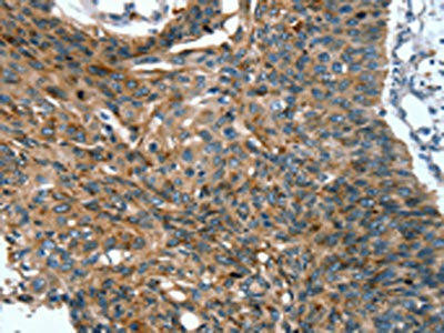 SCPEP1 Antibody (PACO16992)