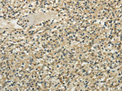 TULP2 Antibody (PACO17337)