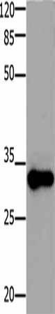 ADO Antibody (PACO17495)