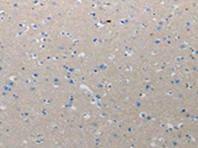 CMTM1 Antibody (PACO17706)