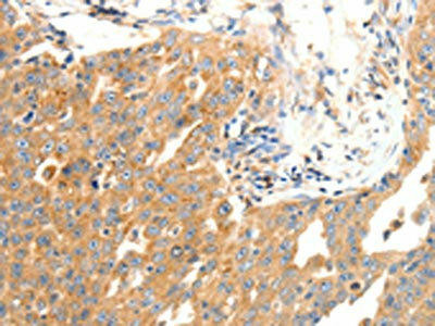 DOPEY1 Antibody (PACO18483)