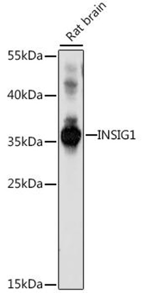 Anti-INSIG1 Antibody (CAB16278)
