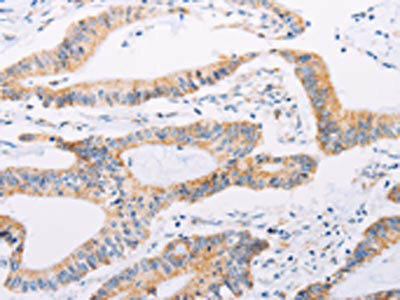 ADAMTS16 Antibody (PACO19060)