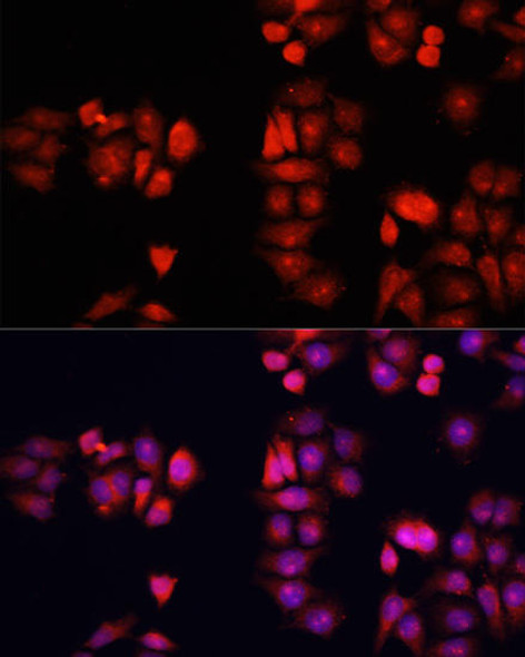 Anti-BMP1 Antibody (CAB16353)