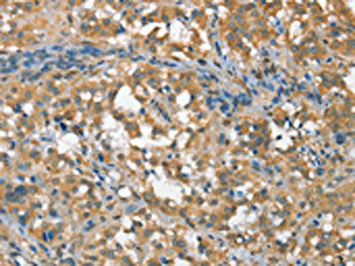 CSMD1 Antibody (PACO19522)