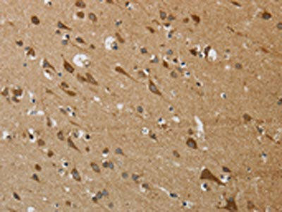 KCNMB4 Antibody (PACO19892)