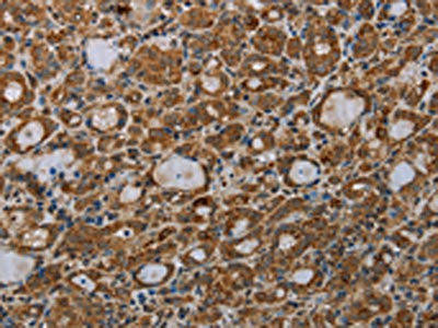 MDFIC Antibody (PACO19999)