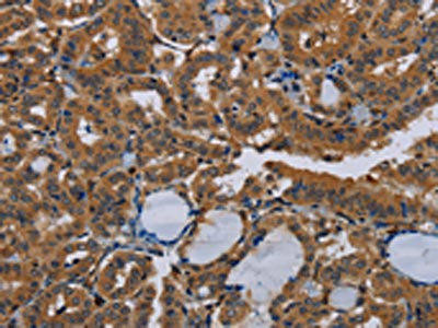 NPTX1 Antibody (PACO20123)