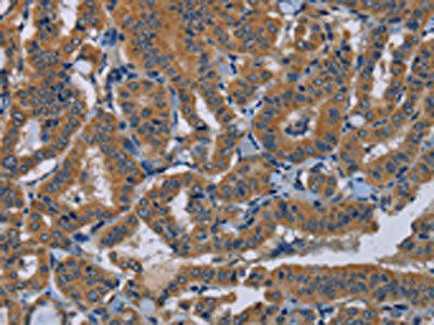 NPTX1 Antibody (PACO20124)