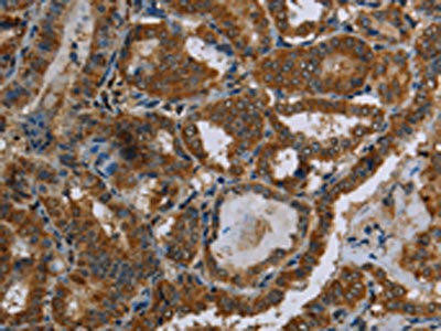 OCC1 Antibody (PACO20135)