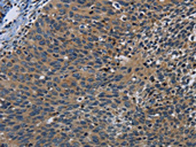 PCDHB15 Antibody (PACO20191)