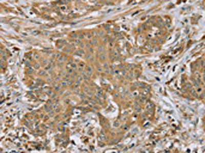 RNF148 Antibody (PACO20353)