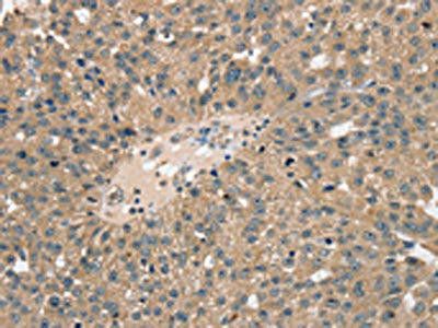 TRIM3 Antibody (PACO20358)