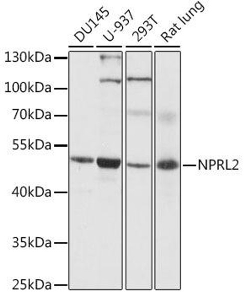 Anti-NPRL2 Antibody (CAB16486)