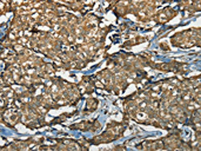 NEMF Antibody (PACO20413)
