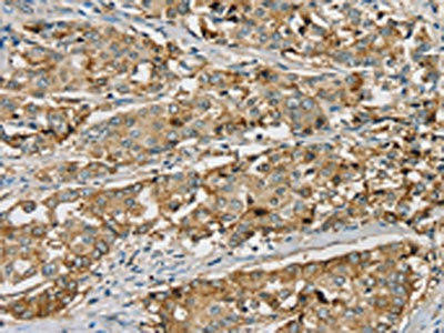 SEMA6A Antibody (PACO20421)