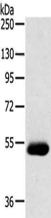 SERINC4 Antibody (PACO20441)