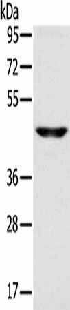 SLC16A8 Antibody (PACO20475)