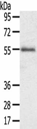 SLC43A2 Antibody (PACO20512)