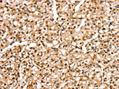 STK32B Antibody (PACO20619)