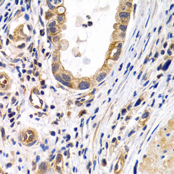 Anti-PTGIR Antibody (CAB1849)