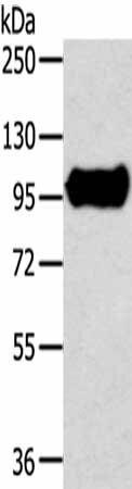 TRIM71 Antibody (PACO20703)