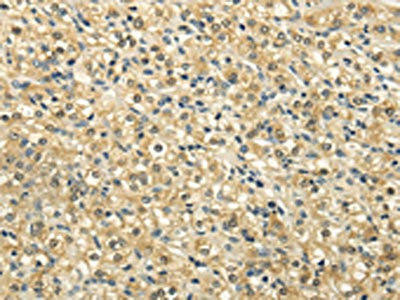 NSD1 Antibody (PACO20829)