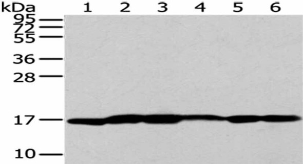 UTS2B Antibody (PACO20844)