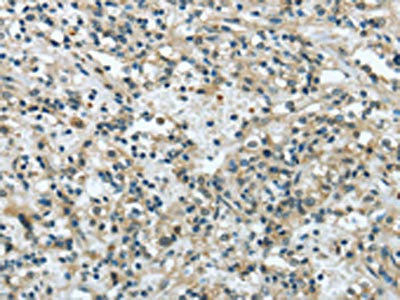 VPS4A Antibody (PACO20861)