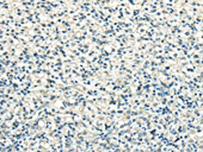 VPS36 Antibody (PACO20867)