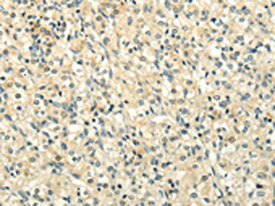 BRWD1 Antibody (PACO20872)