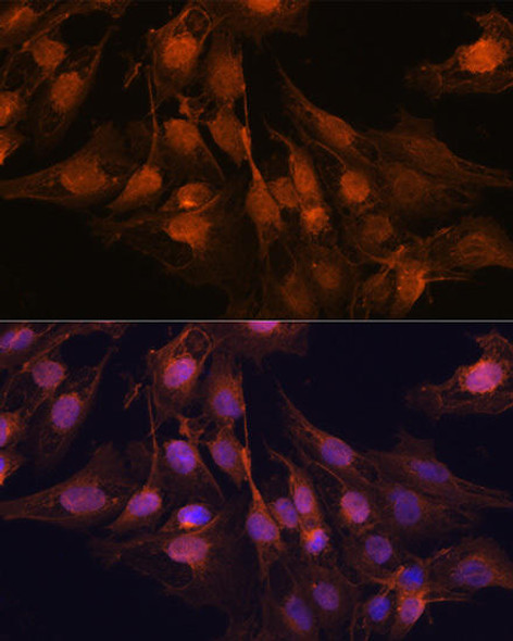 Anti-UCHL1 Antibody (CAB2131)