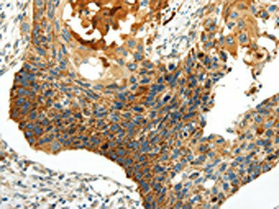 WNT8A Antibody (PACO20919)