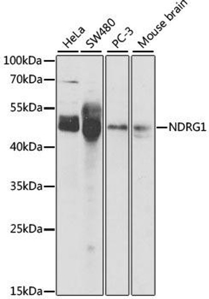 Anti-NDRG1 Antibody (CAB2142)