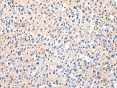 ZNF420 Antibody (PACO20965)