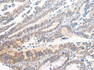 APLN Antibody (PACO20971)
