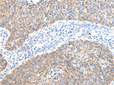 AXIN1 Antibody (PACO20993)
