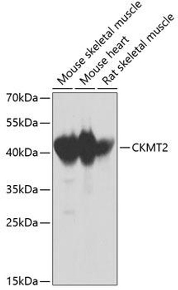 Anti-CKMT2 Antibody (CAB2206)