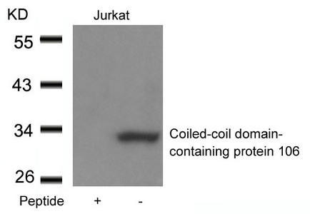 CCDC106 Antibody (PACO21540)