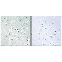 PLA1A Antibody (PACO22502)