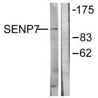 SENP7 Antibody (PACO23149)