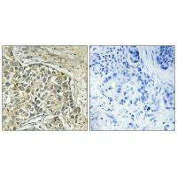 ARSD Antibody (PACO23386)