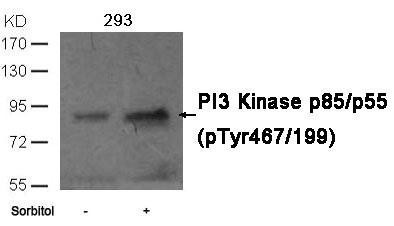 Phospho-PIK3R1/PIK3R3 (Tyr467/199) Antibody (PACO23894)