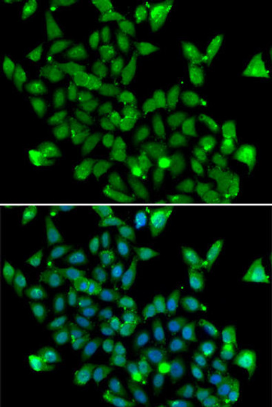 Anti-ASPA Antibody (CAB7271)