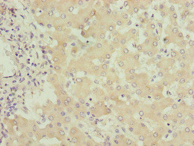 FMO4 Antibody (PACO26801)