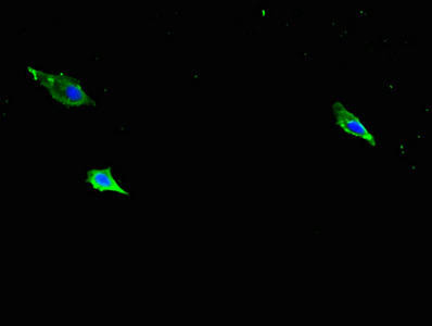 Itgb1 Antibody (PACO27689)