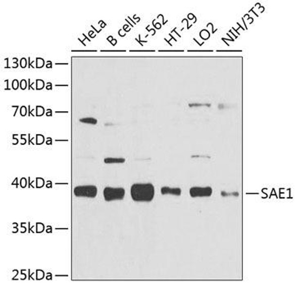 Anti-SAE1 Antibody (CAB9960)